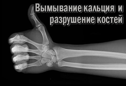 Факторы, способствующие вымыванию кальция и разрушению костей